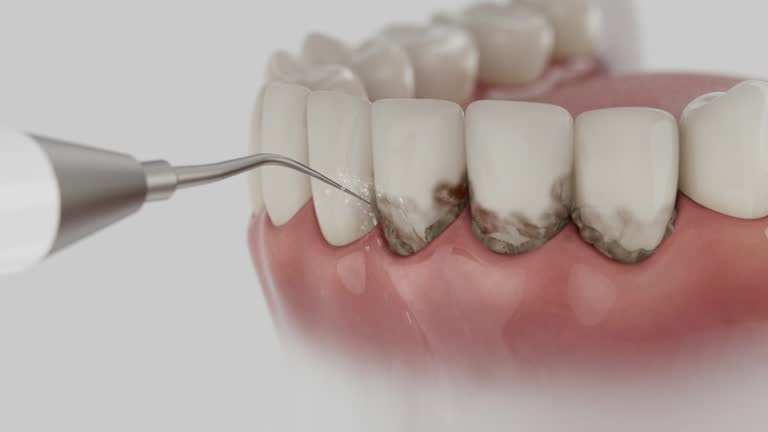 Reliable Dental Implants contractor in Martindale, TX by Smile Center Dentistry